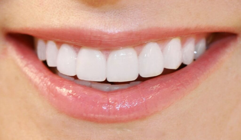 Độ bền của răng sứ được bao lâu
