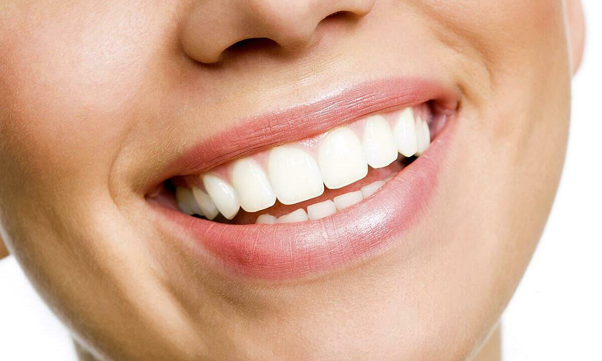 Làm trắng răng tại nhà bằng 5 cách đơn giản sau đây