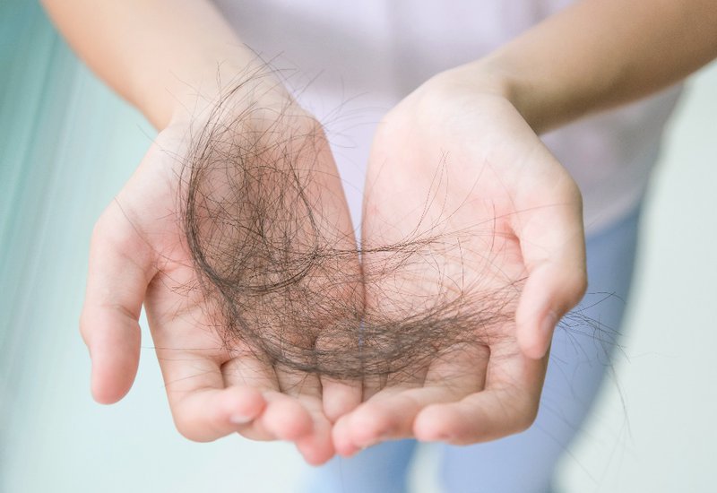 Rụng tóc thiếu chất gì? Nguyên nhân gây rụng tóc